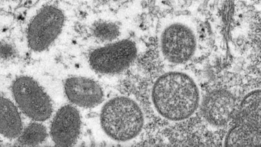 portugal-confirms-276-cases-of-monkeypox